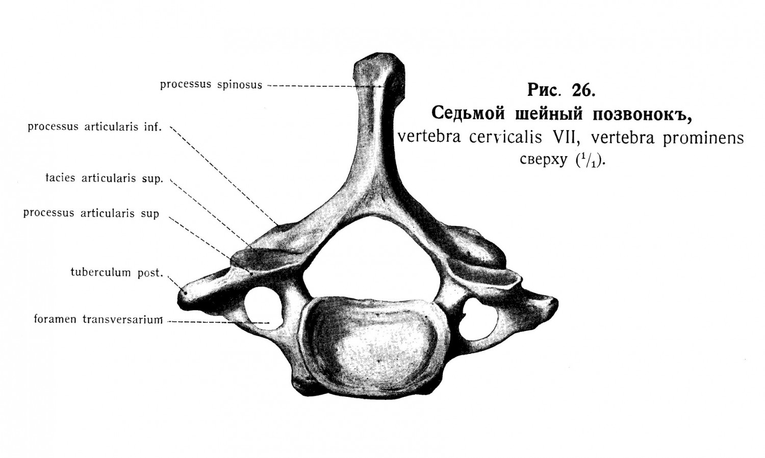 Шейные позвонки, vertebrae cervicales